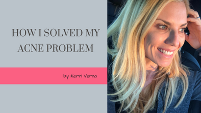 How I Solved My Acne Problem!